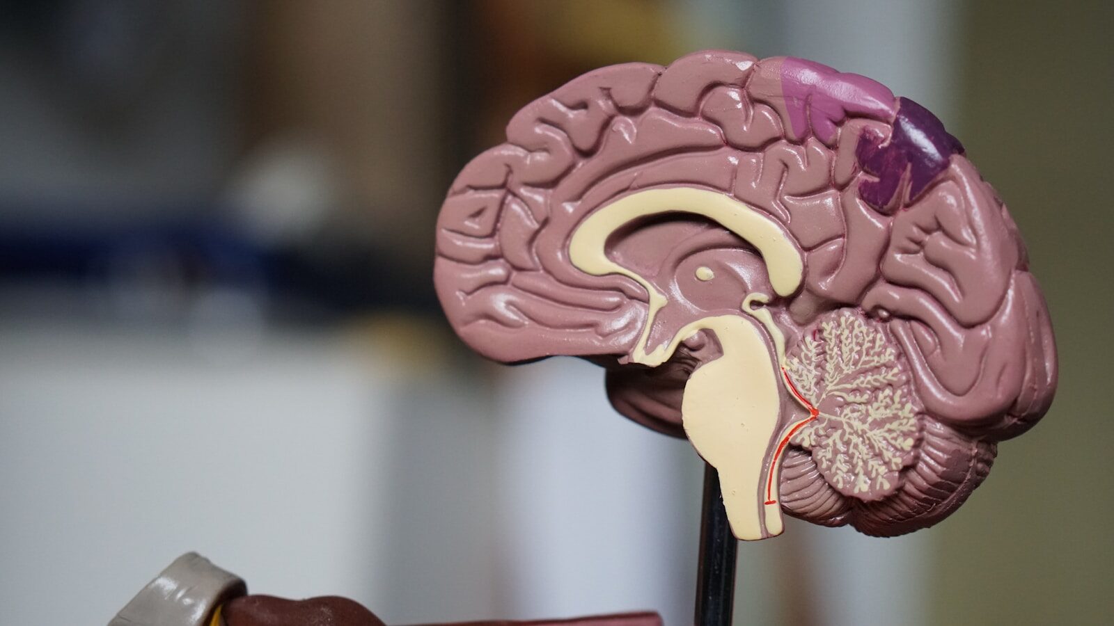 Modelo anatómico del cerebro humano representando el papel del cortisol y la dopamina en la ansiedad